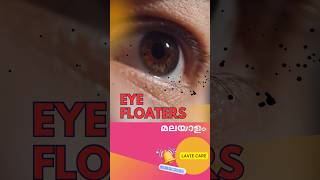 നിങ്ങളുടെ കണ്ണിലെ floaters നെ കൂടുതൽ അറിയാം malayalam eyecare floa [upl. by Hsetih]