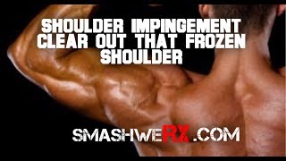 Shoulder Impingement Syndrome Yeah Do This  Trevor Bachmeyer  SmashweRx [upl. by Oirelav]