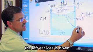 How to read an Audiogram  Better Hearing Center of Austin [upl. by Aivek260]