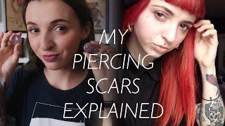 My Piercing Scars Explained [upl. by Vine15]