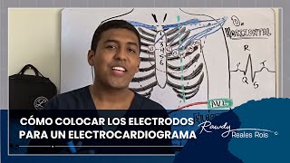 CÓMO COLOCAR LOS ELECTRODOS PARA UN ELECTROCARDIOGRAMA ECG  DR RAWDY [upl. by Astrea690]