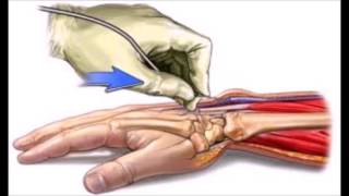 Ficha Tecnica de Aztreonam Monobactamicos [upl. by Akili]