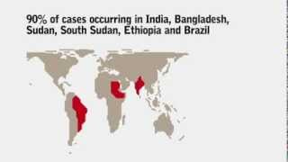 What do you know about Visceral Leishmaniasis Kala Azar [upl. by Wiatt]