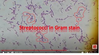 Streptococcus agalactiae [upl. by Verena]