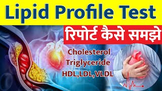 Lipid profile test in Hindi I Lipid profile Test Report कैसे समझे I [upl. by Basso]