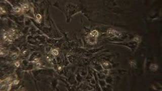 Beating Human Heart Cells from Embryonic Stem Cells [upl. by Leitao564]