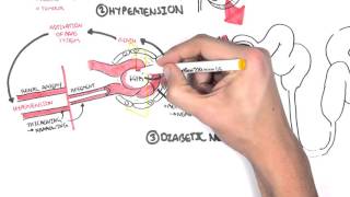 Chronic Kidney Disease CKD Pathophysiology [upl. by Euqinamod388]