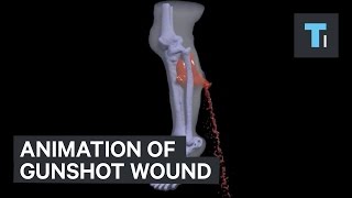 Animation of gunshot wound [upl. by Sabella]