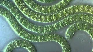 Cyanobacteria under microscope [upl. by Netsyrc]