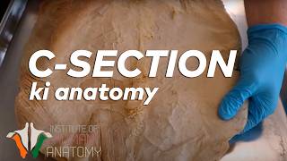 CSection ki Anatomy in Hindi [upl. by Laux]