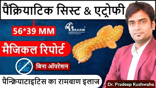 Atrophy Pancreatitis Treatment  Pseudocyst Pancreatitis treatment hindi  Best Pancreas treatment [upl. by Yelyr]