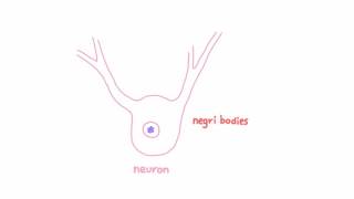 Rabies  Pathogenesis Clinical Presentation and Diagnosis [upl. by Leanor]