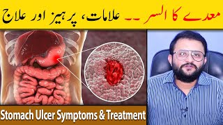 Stomach Ulcer Symptoms amp Treatment  Stomach Ulcer Ka Ilaj  Maidey Ka Ulcer  Dr Raja Omer Fiaz [upl. by Blas]