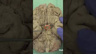 Ventral aspect of hypothalamus anatomy neuroanatomyhypothalamusbrainbrainanatomy [upl. by Kcinimod]