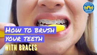 How to Brush with Braces  3 Brushing Tips [upl. by Dranyer655]