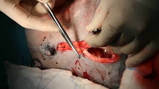 Splenectomy in a dog [upl. by Yenhoj611]