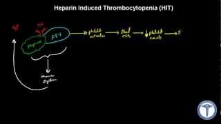 Heparin Induced Thrombocytopenia HIT Explained  MADE EASY [upl. by Nosiaj]