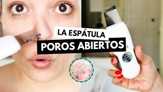 Pruebo la ESPÁTULA ULTRASÓNICA contra POROS ABIERTOS y sebo facial  Pretty and Olé [upl. by Akimak33]