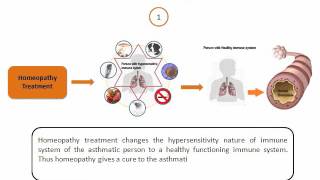 Permanent solution for Asthma [upl. by Boni]