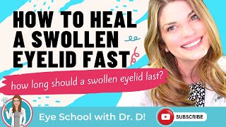 What Is The Fastest Way To Heal A Swollen Eyelid How Long Should A Swollen Eyelid Last [upl. by Andres]