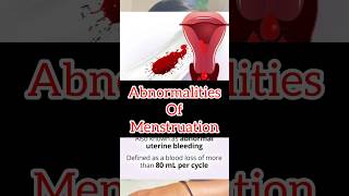 Abnormalities Of Menstruation medicalstudent knowledge shorts cycling periods pain [upl. by Enilorac]