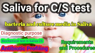 Saliva culture and sensitivity test Saliva for CS [upl. by Nesto]