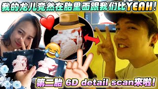 我的龙儿竟然在胎里面跟我们比yeah！！感觉很像Tara～第二胎detail scan来啦！ [upl. by Eiroj774]