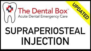 Supraperiosteal Injection Technique local tooth block [upl. by Atener]