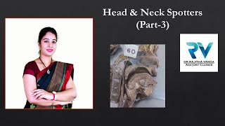 Head amp Neck Spotters Part3 by Dr Rajitha Vanga [upl. by Tabatha]