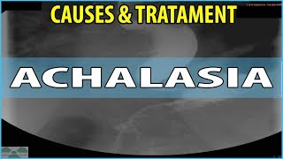 What is Achalasia Causes Symptoms and Treatments [upl. by Ayekel]