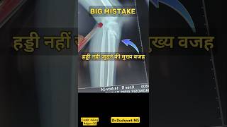 WHY Bone Failed To Unite🔥 मुख्य कारण 💥fracturerecovery fracturehealing fracture [upl. by Artcele410]