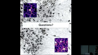 Midbrain Microglia Unique Cell Phenotypes and their Impact on Neuronal Function [upl. by Adnuhsal]