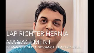 Lap Richter Hernia Management  Dr Manish K Gupta [upl. by Eelik513]