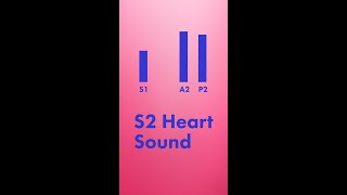 Split S2 Heart Sound  Shorts [upl. by Eldridge]