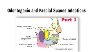 Odontogenic and Fascial Spaces Infections طب الأسنان مرحلة رابعة oralsurgery [upl. by Bobbette]