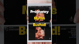 Pregnancy Myths Busted 🤯 Whats Fact vs Fiction [upl. by Lek130]