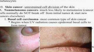 Skin Disorders Integumentary Lecture [upl. by Normie250]