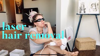 At Home Hair Removal BOSIDIN Laser from AMAZON  UNBOXING plus First Treatment [upl. by Ful]