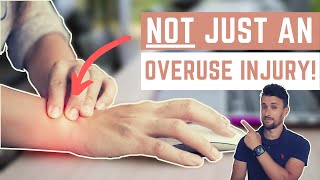 Repetitive Strain Injuries RSI Why Overuse Alone Is Not the Cause [upl. by Ingram]