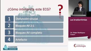 Electro caso rápido Dr Felipe Rodriguez Entem [upl. by Noret]