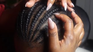 Crisp Brain Tingling SCALP SCRATCHING ASMR between braids 💤  no talking [upl. by Munt353]