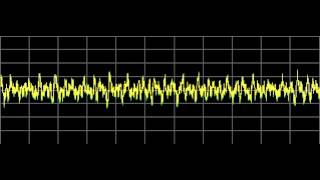 Lupus  Rife Frequencies [upl. by Naz]