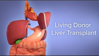 Medical Animation Living Donor Liver Transplant  Cincinnati Childrens [upl. by Pradeep]