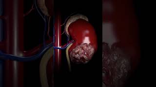 Kidney Animation Video Explained [upl. by Narcho]