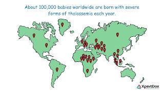 What is Thalassemia [upl. by Gunner126]