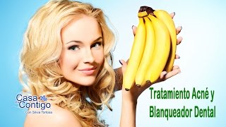 Tratar Acne y Blanquear los Dientes con Platano [upl. by Whitebook748]