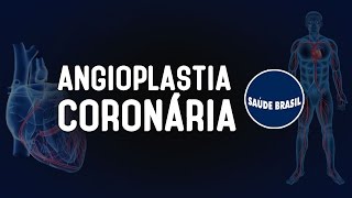 ANGIOPLASTIA CORONÁRIA  SÉRIE SAÚDE BRASIL [upl. by Gypsy]