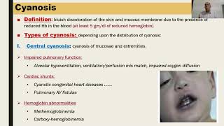 General examination Pallor and Cyanosis [upl. by Ragan664]