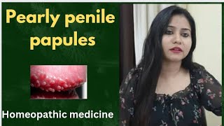 Pearly penile papules homeopathic medicine  PPP symptomscauses amp homeopathic medicines  hindi [upl. by Natanoy29]