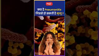 क्या है Pneumonitis जिससे हो सकती है मृत्यु riteshjaiswalsir science shorts viral sanskritiias [upl. by Boot]